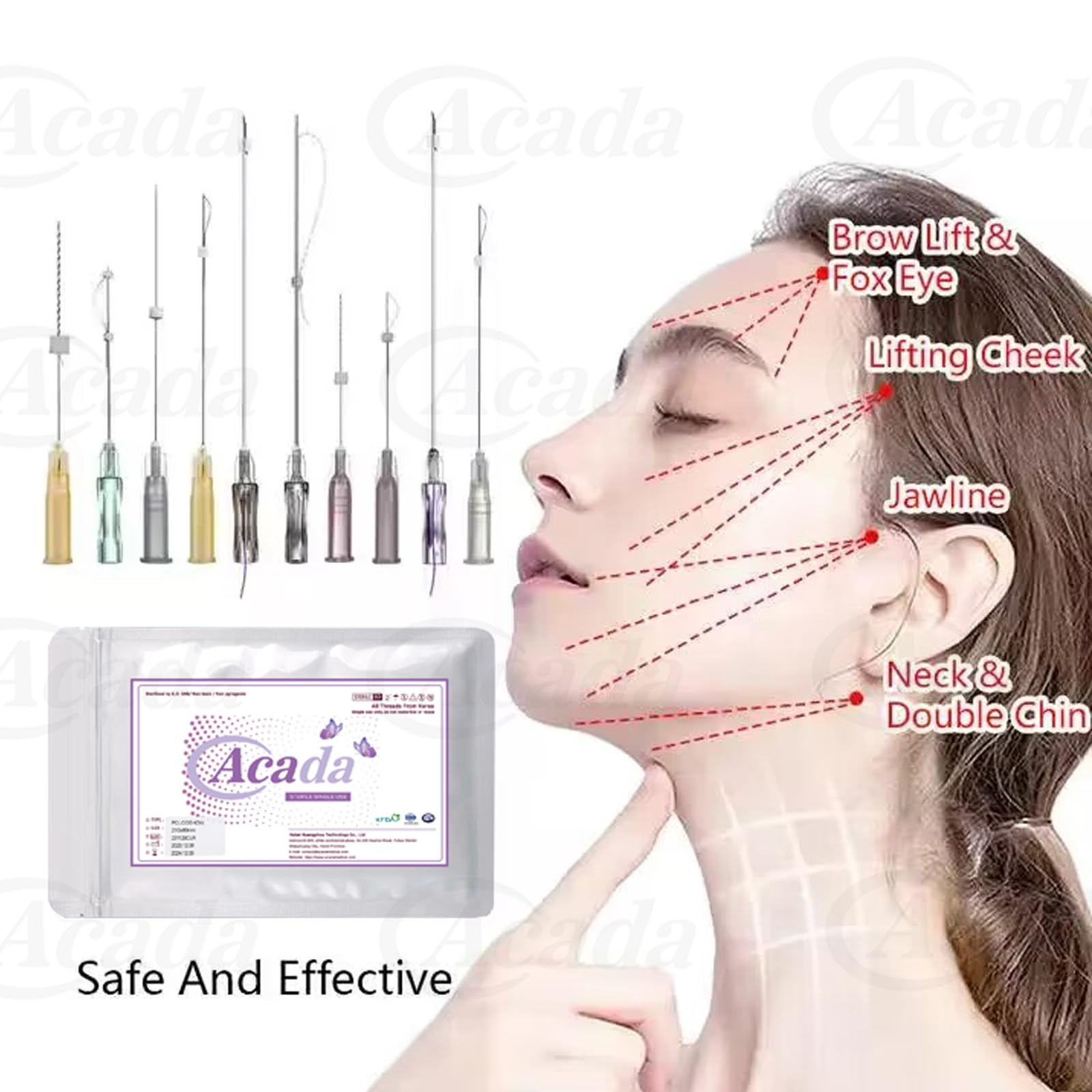 PCL Cog Threads for Face Lift , Fox Eye Lift Brow Lift  Blunt Type 21G60mm - 20Pcs