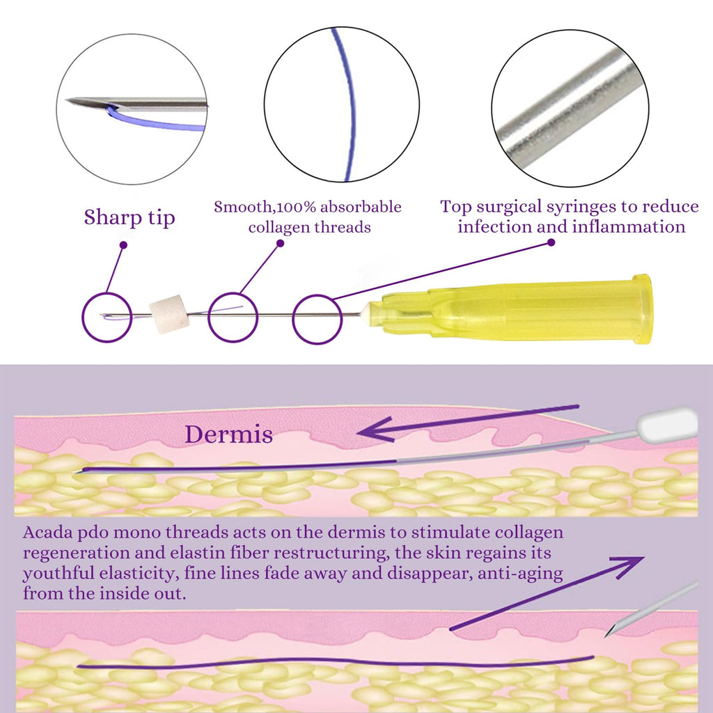 PDO Mono Smooth Collagen Threads for Face Lift 26G60mm - 20pcs