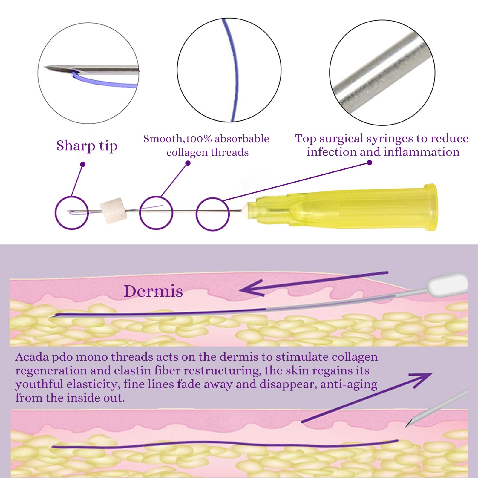 PDO Mono Smooth Collagen Threads for Face Lift 26G60mm - 20pcs