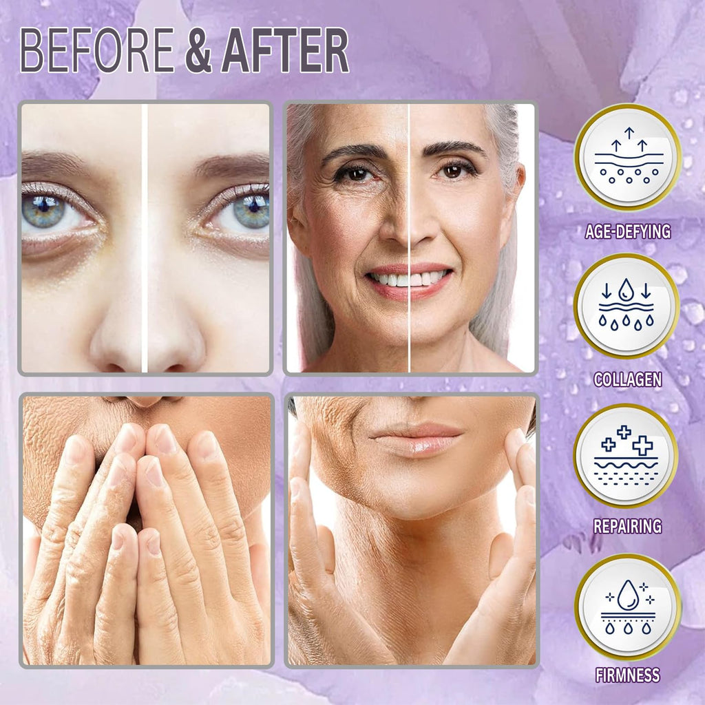 PDO Mono Smooth Collagen Threads for Face Lift 26G60mm - 20pcs