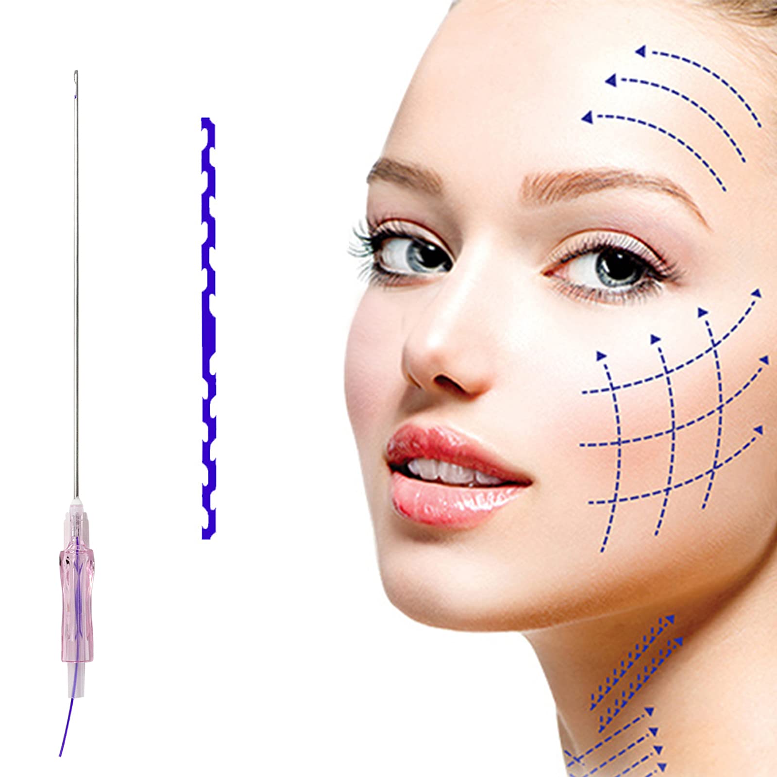 PDO Thread Molding Cog Type Lifting Threads 18G-100mm 20pcs