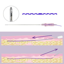 Load image into Gallery viewer, PDO Thread Molding Cog Type Lifting Threads 18G-100mm 20pcs
