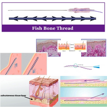 Load image into Gallery viewer, PDO Thread Fishbone Line Molding Cog PDO Thread 18G-100mm 20pcs
